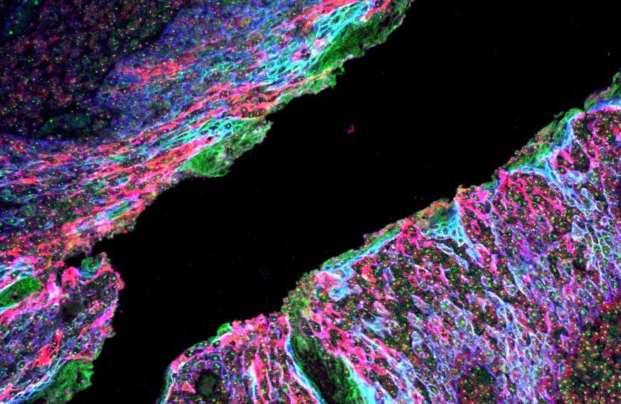 human tonsils, FFPE section, 4-plex with commercially available antibodies
