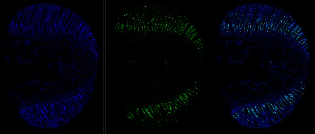 human rectum, FFPE, DAPI and 1-plex stain with 488 nm fluorophore