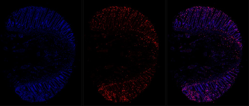 human rectum, FFPE, DAPI and 1-plex stain with 565 nm fluorophore