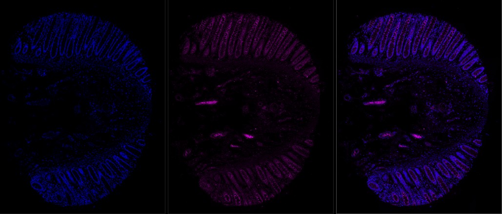 human rectum, FFPE, DAPI and 1-plex stain with 647 nm fluorophore
