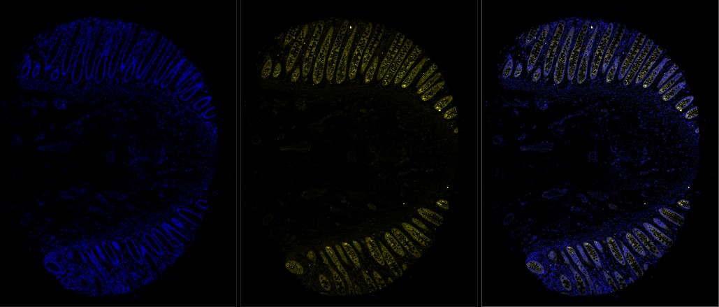human rectum, FFPE, DAPI and 1-plex stain with 750 nm fluorophore