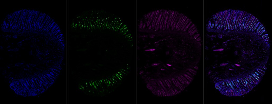human rectum, FFPE, DAPI and 2-plex stain with 488 and 647 nm fluorophores