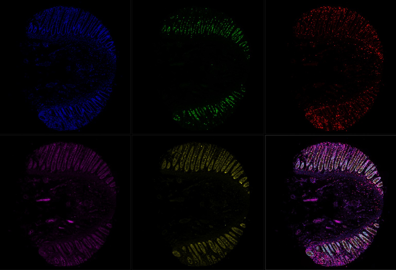 human rectum, FFPE, DAPI and 4-plex stain with 488, 565, 647 and 750 nm fluorophores